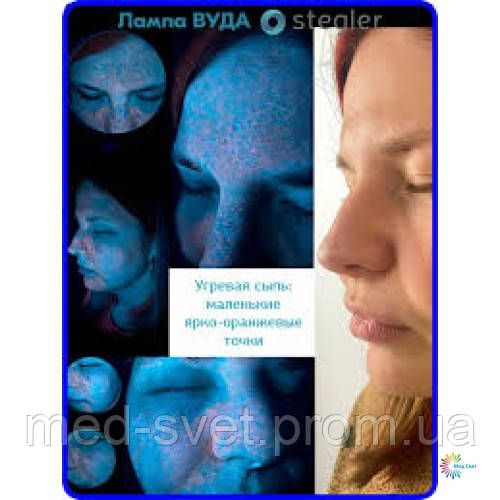 Лампа Вуда BZ-300 профессиональная с увеличением 2.5× | Зображення 4