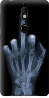 Чохол для Nokia 7 з силікону FCh_061836