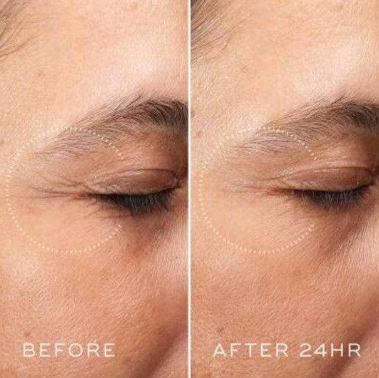Крем для зони навколо очей Medik8 Crystal Retinal Ceramide Eye 3 15ml | Зображення 1