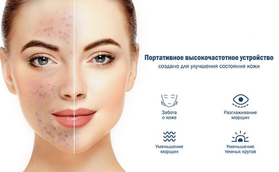 Портативна Дарсонваль MEDICA+ Darsoline 4.0 ( Японія) | Зображення 5