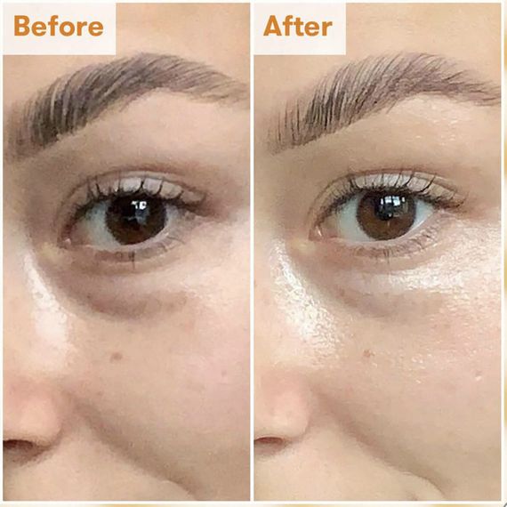 Крем для очей REN CLEAN SKINCARE RADIANCE BRIGHTENING DARK CIRCLE EYE CREAM 15ML | Зображення 3