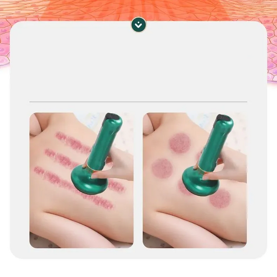 Вакуумний антицелюлітний масажер для тіла масаж гуашю Cupping Massager GREEN | Зображення 3