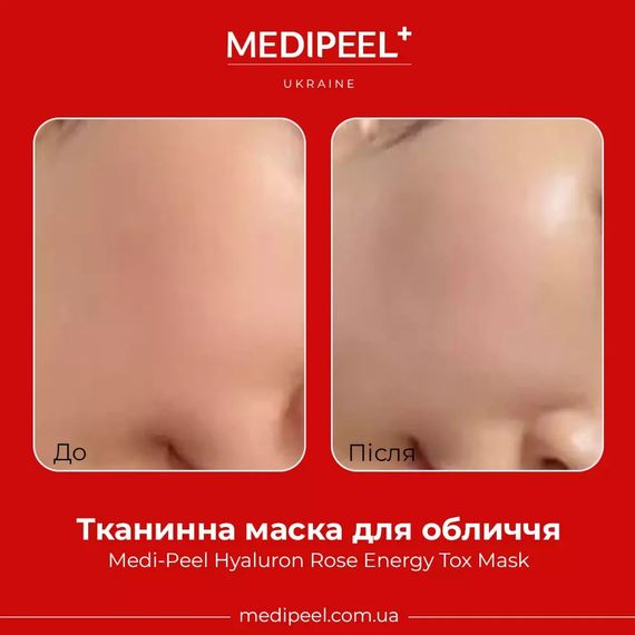 Тканинна ампульна маска Medi-Peel Hyaluron Rose Moisture Ampoule Mask (1 ea) | Зображення 1