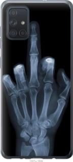 Чехол на Samsung Galaxy A71 2020 A715F Рука через рентген из пластика FCh_062528