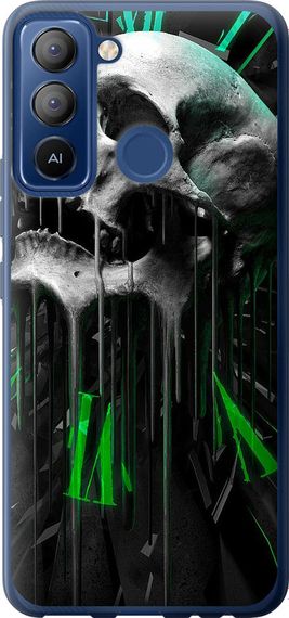 Чехол на Tecno POP 5 LTE BD4 Череп-часы "4100u-2639-17620"