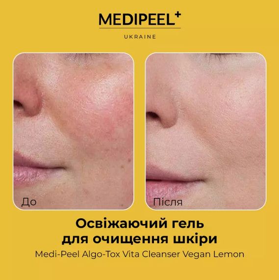 Пенка для очищения кожи MEDI-PEEL Algo-Tox Vita Cleanser Vegan Lemon (150 ml) | Зображення 2