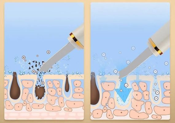 Скрабер ультразвуковий SCRUBBER Апарат для чищення обличчя 3в1, очисний, зволожувальний, згладжувальний
