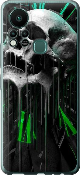 Чехол на Infinix Hot 11S Череп-часы "4100u-2757-17620"