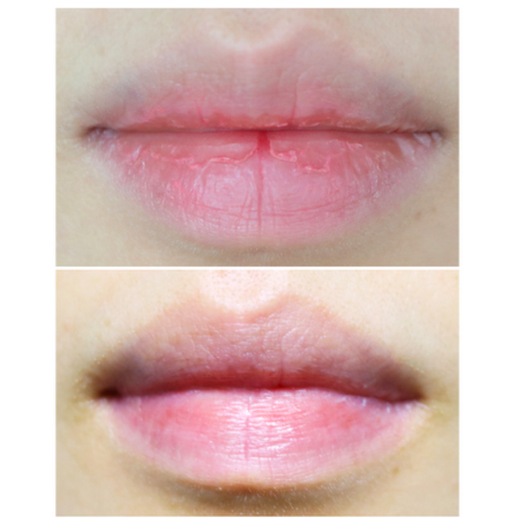 Маска для губ Care:NEL Lip Night Mask - Pomegranate (5 g) | Зображення 1