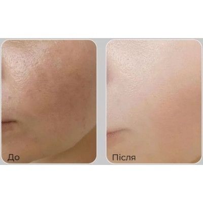 Крем для лица с пептидами и комплексом витанола Medi-Peel Peptide 9 Vitanol Cream Pro (50 ml) | Зображення 3