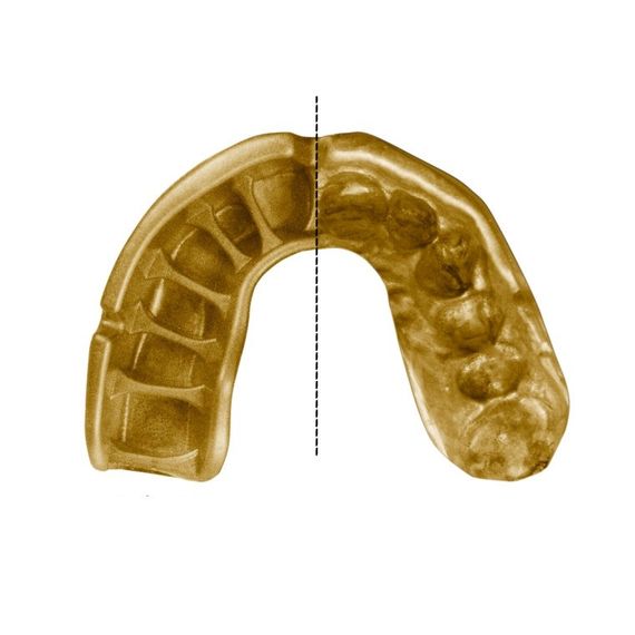 Капа OPRO Gold доросла (вік 11+)  Grillz Black/Gold (art.102504012) | Зображення 2