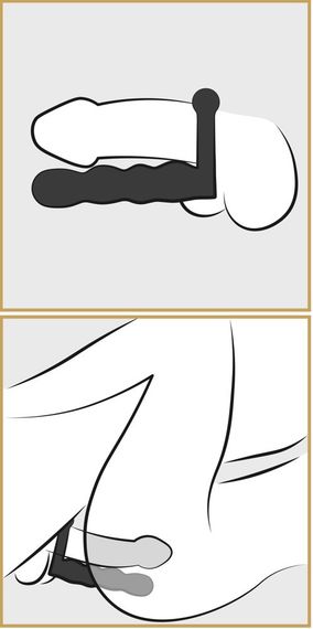 Насадка на член для подвійного проникнення з віброкільцем Posable Partner Double Penetrator sexstyle | Зображення 7