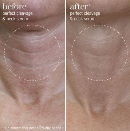 Сироватка для шиї та зони декольте This Works Perfect Cleavage & Neck Serum  20ML | Зображення 3