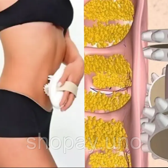 Массажер антицеллюлитный Shuqin Body Slimmer SQ 100 | Зображення 2