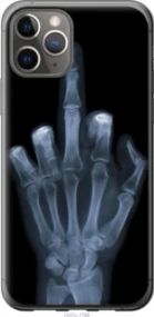 Чехол на iPhone 11 Pro Рука через рентген из пластика FCh_062041