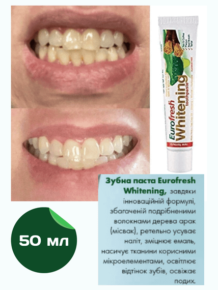 Відбілююча зубна паста Farmasi Eurofresh Whitening 50 г | Зображення 2