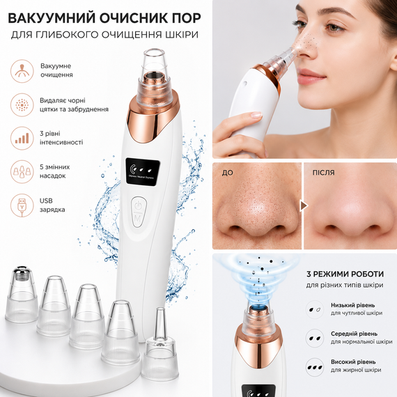 Вакуумний Очищувач Пор Обличчя 5 в 1 — Видалення Чорних Крапок | Зображення 2