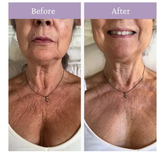Prai Ageless Throat & Decollete Cream - крем для шеи и зоны декольте, 30 мл | Зображення 2