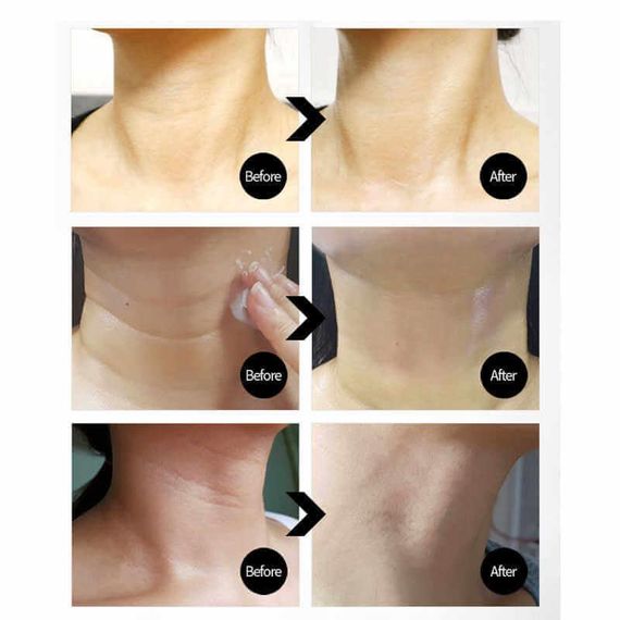 Подтягивающий крем для шеи Medi-Peel Naite Thread Neck Cream с пептидным комплексом 100 мл | Зображення 2