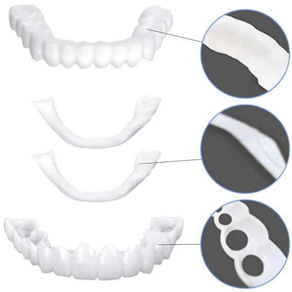 Съемные виниры для зубов Snap On Smile на 2 челюсти • Накладные виниры на верхнюю и нижнюю челюсть для красивой улыбки | Зображення 3