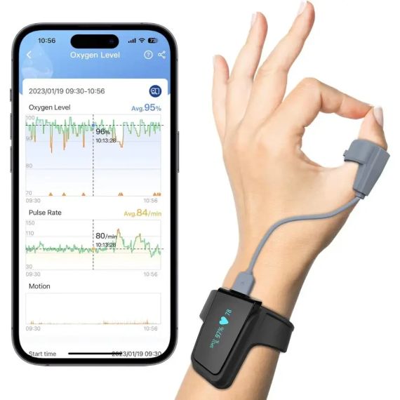 Пульсоксиметр ViATOM Checkme O2 Max з Bluetooth, кільцевий датчик, безперервний моніторинг SpO2 і пульсу, додаток Vihealth