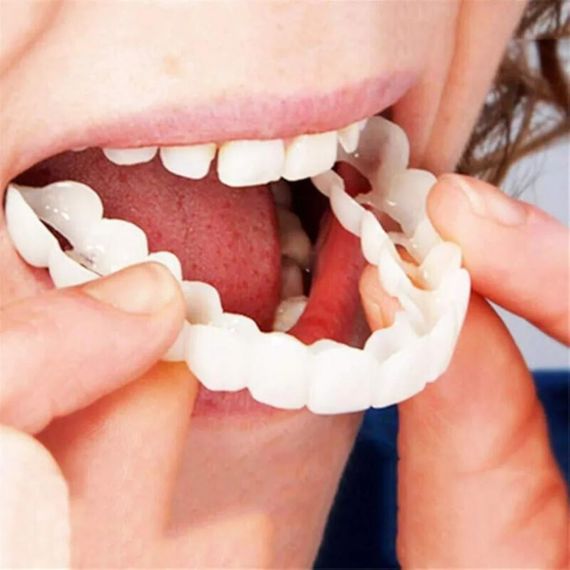 Съемные виниры для зубов Snap On Smile на 2 челюсти • Накладные виниры на верхнюю и нижнюю челюсть для красивой улыбки | Зображення 4