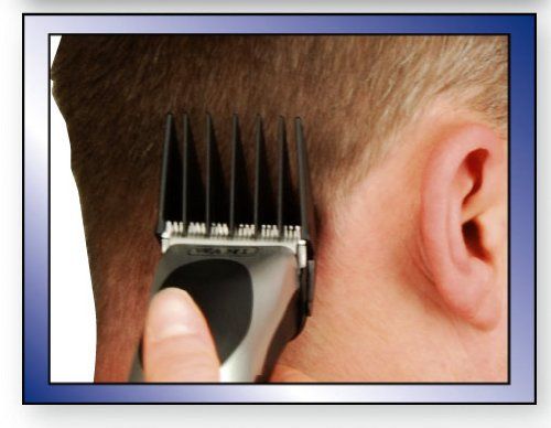 Moser WAHL HomePro 09243-2216 (09243-2216) | Зображення 5