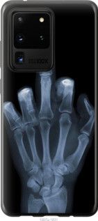 Чехол на Samsung Galaxy S20 Ultra Рука через рентген из пластика FCh_062494