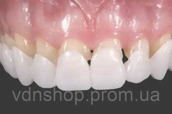 Вініри для зубів верх Snap On Smile | Зображення 2