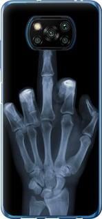 Чохол для Xiaomi Poco X3 Pro з пластику FCh_052197