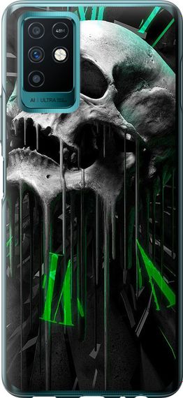 Чехол на Infinix Note 10 Череп-часы "4100u-2763-17620"