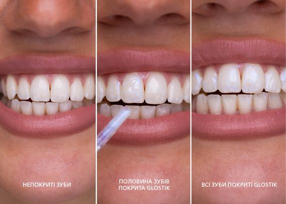 Блиск для зубів SmileKit Glostik | Зображення 3