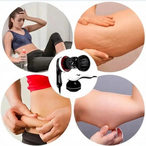 Антицелюлітний масажер покращення кровообігу XPRO Body Slimmer (234573201_529) | Зображення 4