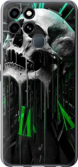 Чехол на Infinix Smart 6 Череп-часы "4100u-2758-17620"