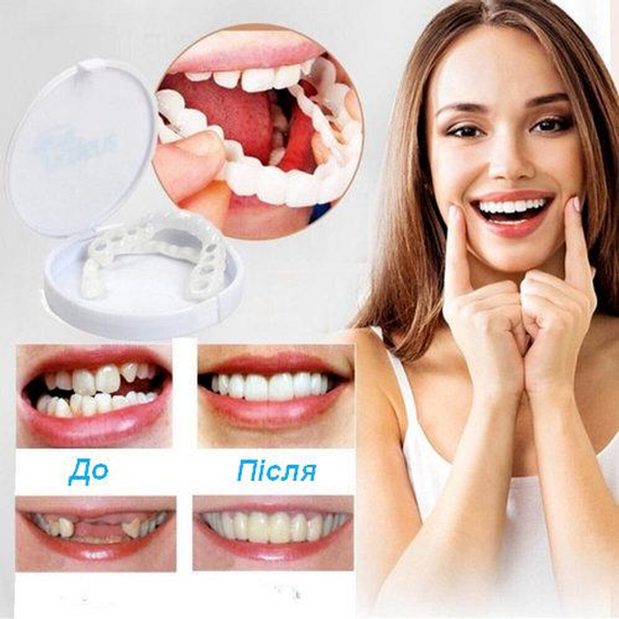 Виниры для зубов верх Snap On Smile | Зображення 1