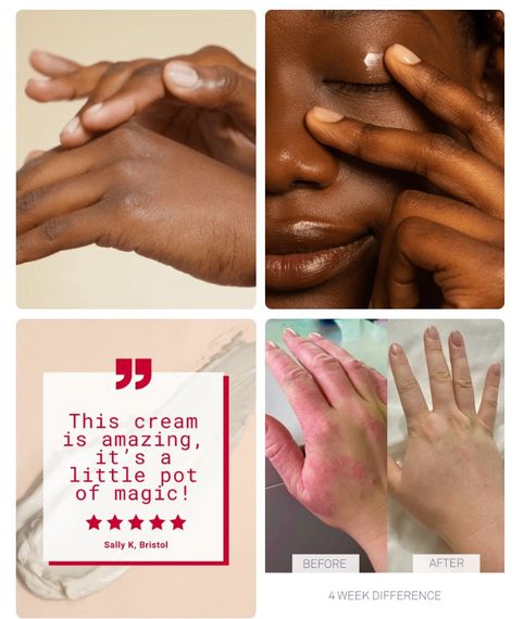 Засіб для відновлення шкіри Nursem CARING SKIN FIX | Зображення 1