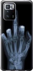 Чохол для Xiaomi Poco X3 GT з силікону FCh_052187