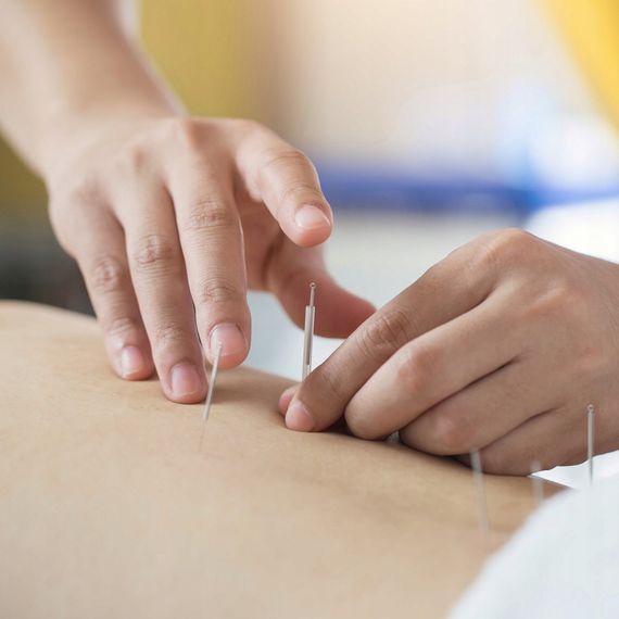 Иглы акупунктурные 4FIZJO 0.3 х 50 мм с направляющей 100 шт 4FJ0551 (P-5907739318954) | Зображення 8