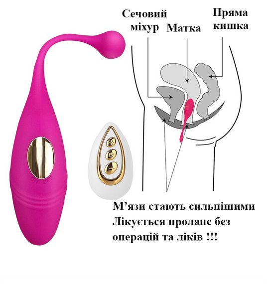 Віброяйце Vibrador Egg з пультом дистанційного керування (червоне, USB) | Зображення 2