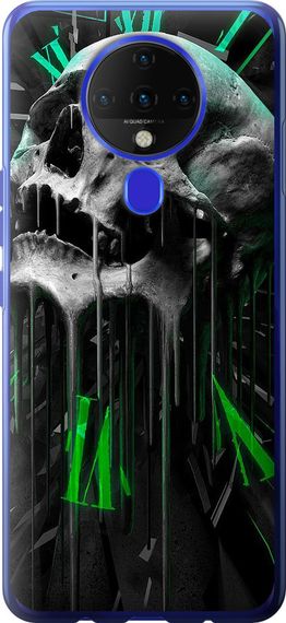 Чехол на Tecno Spark 6 KE7 Череп-часы "4100u-2418-17620"
