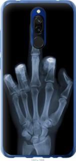 Чохол для Xiaomi Redmi 8 з пластику FCh_062616