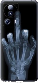 Чехол на Xiaomi 13 Lite Рука через рентген "1007u-3017-17620"