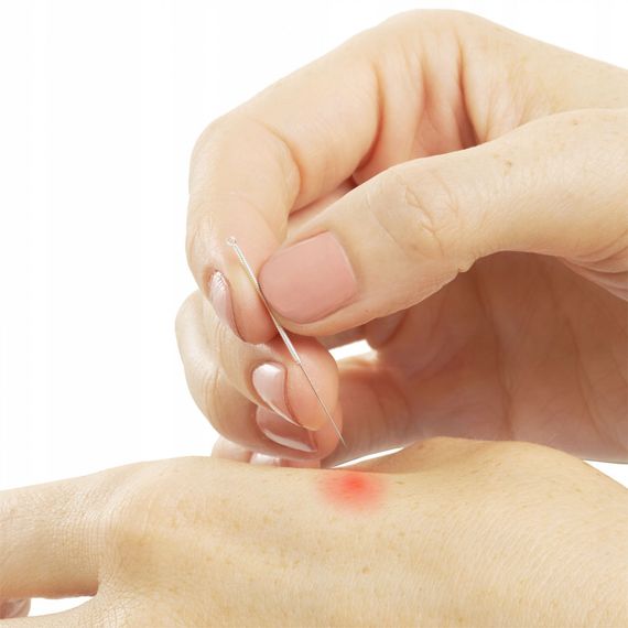 Голки акупунктурні 4FIZJO 0.25 х 25 мм з напрямною 100 шт 4FJ0553 (P-5907739318930) | Зображення 2