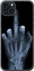 Чохол на iPhone 15 Plus Рука через рентген із силікону FCh_007963