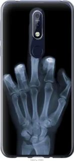 Чохол для Nokia 7.1 з силікону FCh_061838