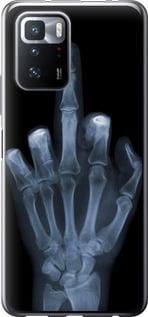 Чохол для Xiaomi Poco X3 GT з силікону FCh_052187