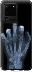 Чехол на Samsung Galaxy S20 Ultra Рука через рентген из пластика FCh_062494
