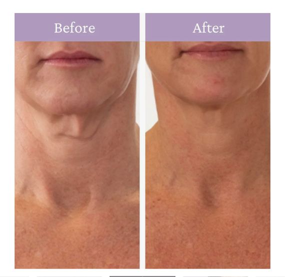 Prai Ageless Throat & Decollete Cream - крем для шеи и зоны декольте, 30 мл | Зображення 1