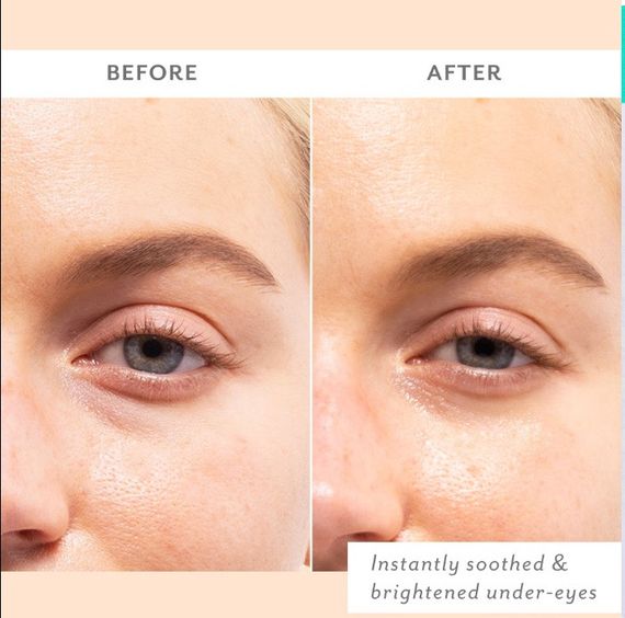 Патчі для очей Patchology Skin Remedy Soothing Eye Gels - 1 шт | Зображення 2