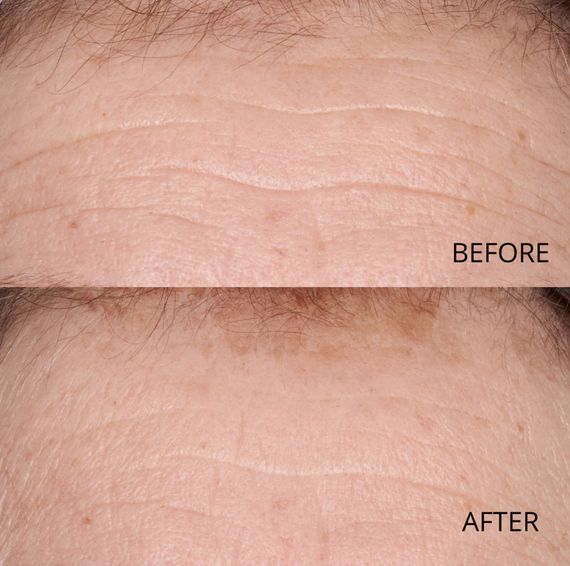 Сироватка для шкіри обличчя Perricone MD Hypoallergenic Clean Correction Smoothing Restorative Serum | Зображення 6